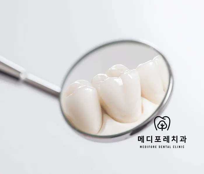 미사역 치과, 충치 치료 방법은 어떻게 결정하나요?