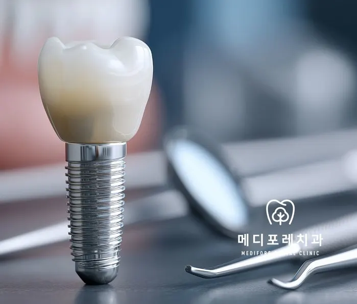 미사역 치과, 임플란트도 실패할 수 있나요?