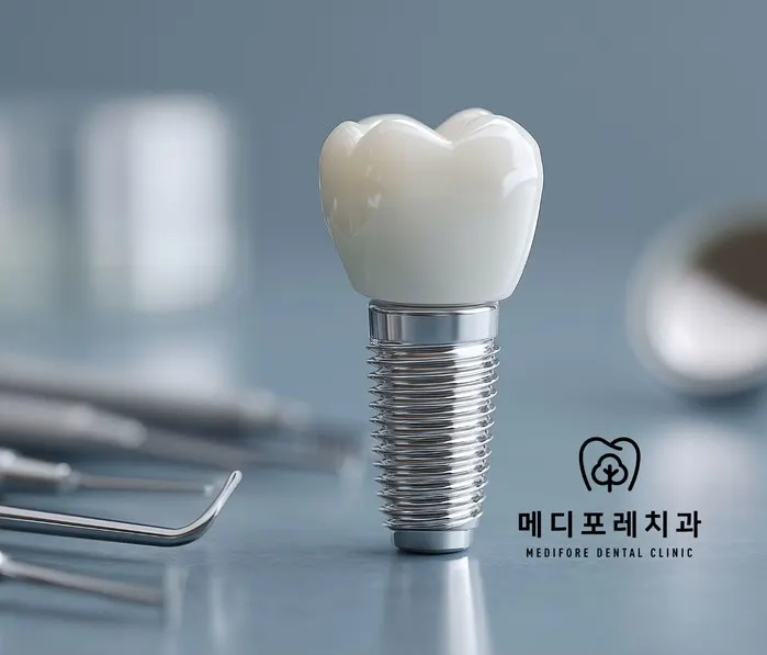 미사역 치과, 발치 후 바로 임플란트를 심을 수 있나요?