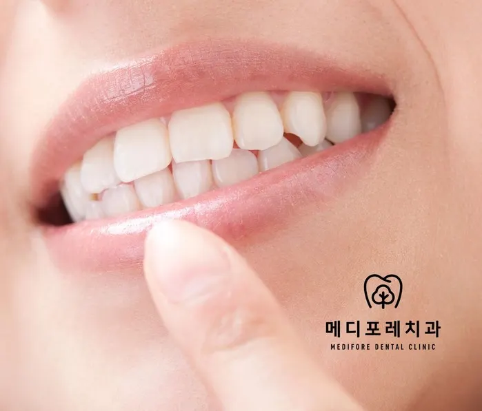 미사역 치과, 입이 자꾸 마르는데 치아에도 영향을 주나요?